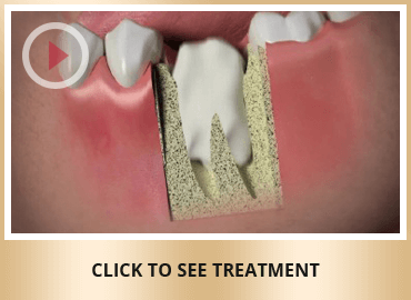 Extractions & Oral Surgery